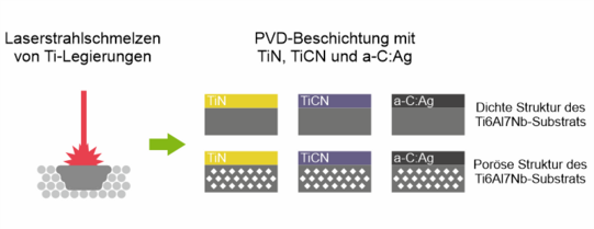 Biofunktionale PVD-Dünnschichten für additiv gefertigte Titanlegierungen in der Implantattechnologie